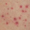 МЕДИЦИНСКИЕ СОВЕТЫ 29_skin-allergy-1