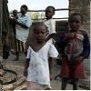 Жертвами холеры в Зимбабве стали 85 000 человек