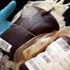 Донорская кровь увеличивает риск возникновения инфекций   