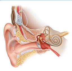Создатель кохлеарного импланта утверждает, что уже сейчас глухие могут услышать музыку