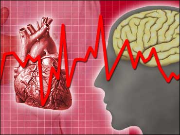 Сердечный приступ и нестабильная стенокардия 