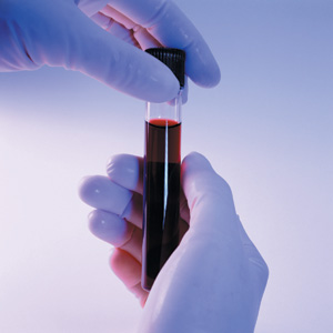 Биохимический анализ крови 